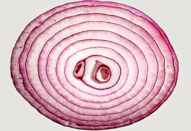 Człowiek jest cebulą