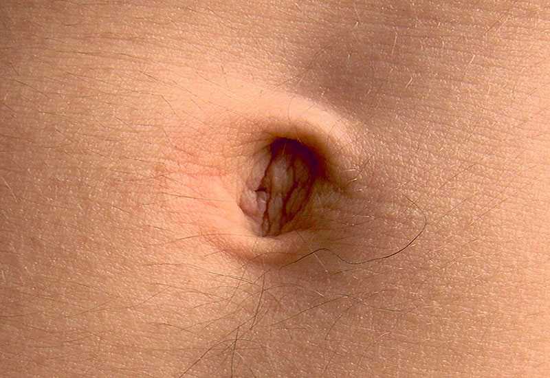 Cywilizacja Zachodnia zapatrzona we własny pępek